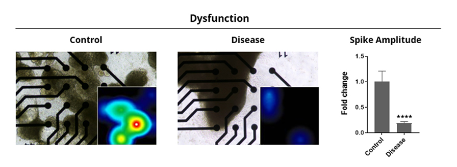 Cardiac Organoids