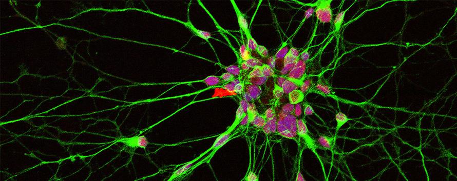 iPSC Derived Neurons