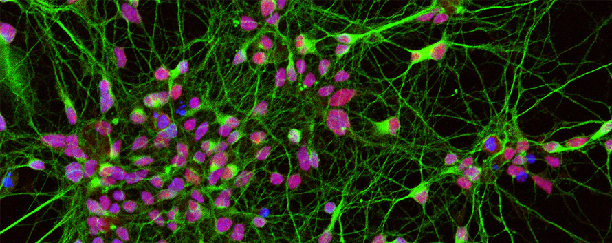 iPSC Derived Neurons